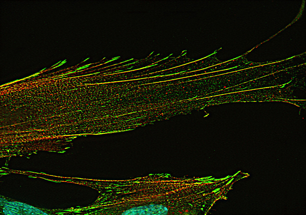 Fluorescence microscopy illuminates uterine muscle cells. Photo by Ayomikun Olaloku. This image was the viewer's choice winner in the 2019 USask Images of Research competition. 